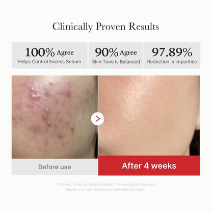 medicube Red Succinic Acid Peeling Pad