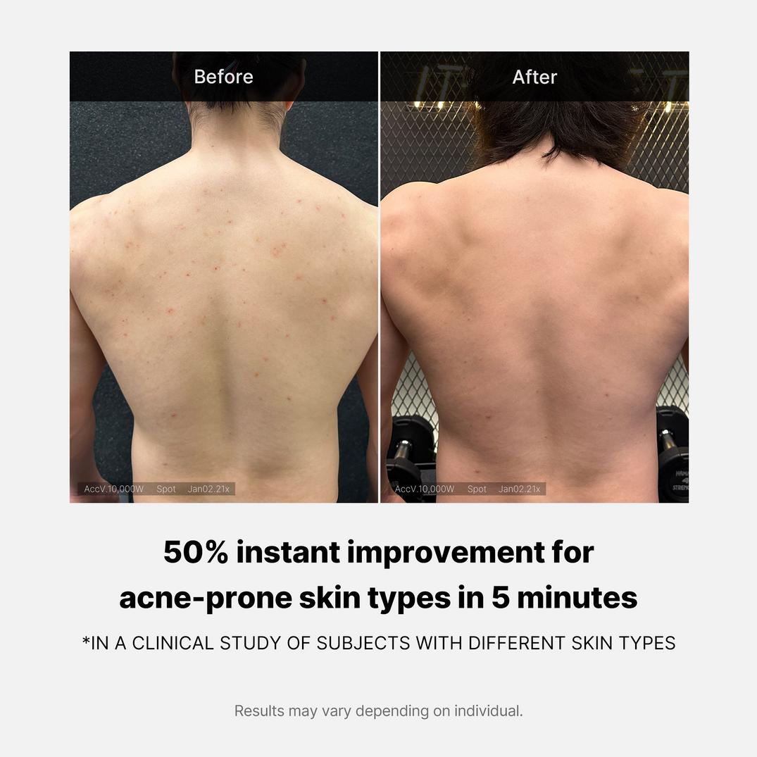 medicube Red Acne Body Wash