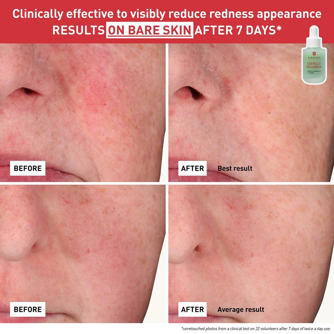 Erborian Centella Red Serum with Korean Centella Asiatica Extract