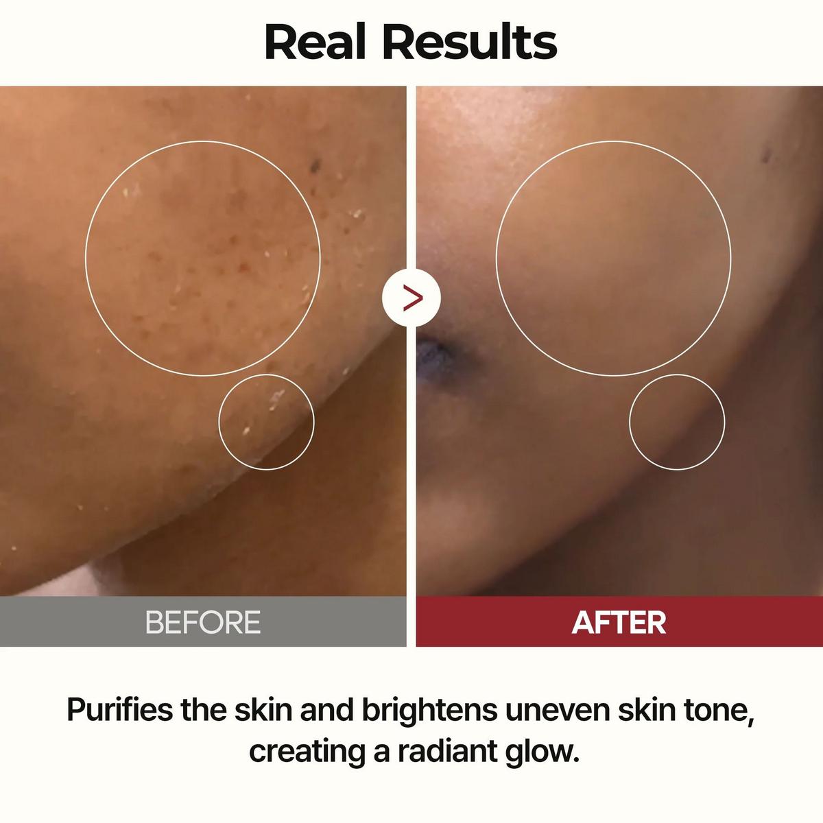 Dr. Melaxin Peel Shot Glow White Rice Toner