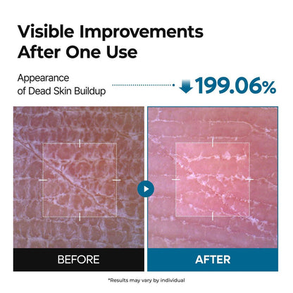 Dr. Melaxin Peel Shot Exfoliating TX-Spray