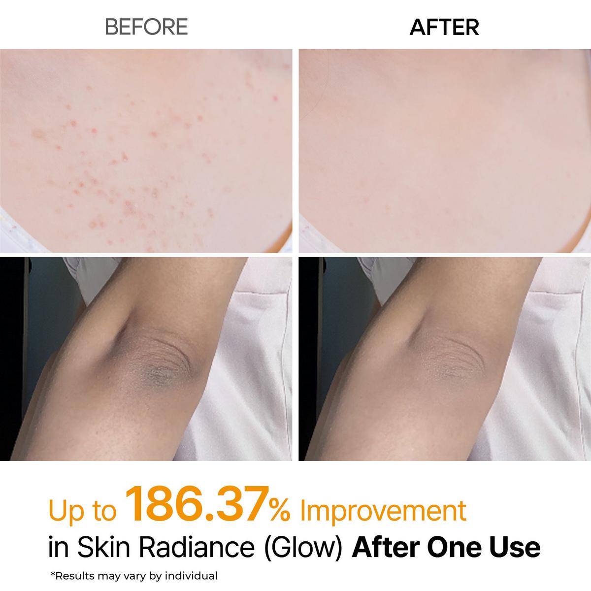 Dr. Melaxin Peel Shot Exfoliating Kojic Acid Turmeric Spray