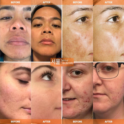 Seoul Ceuticals Korean Skin Care Vitamin C Serum Day Glow Serum