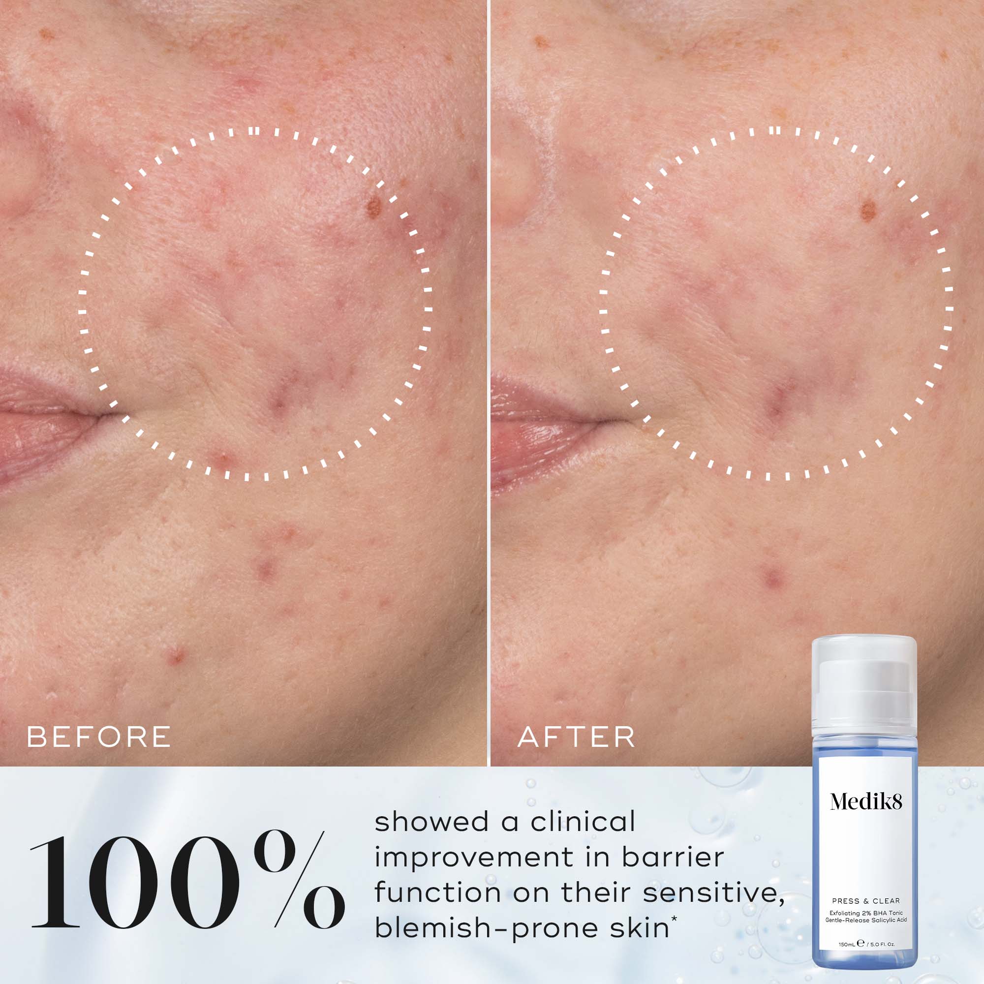 Medik8 Press & Clear Refill