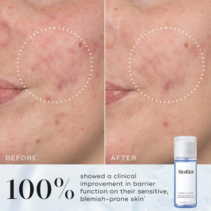 Medik8 Press & Clear Refill
