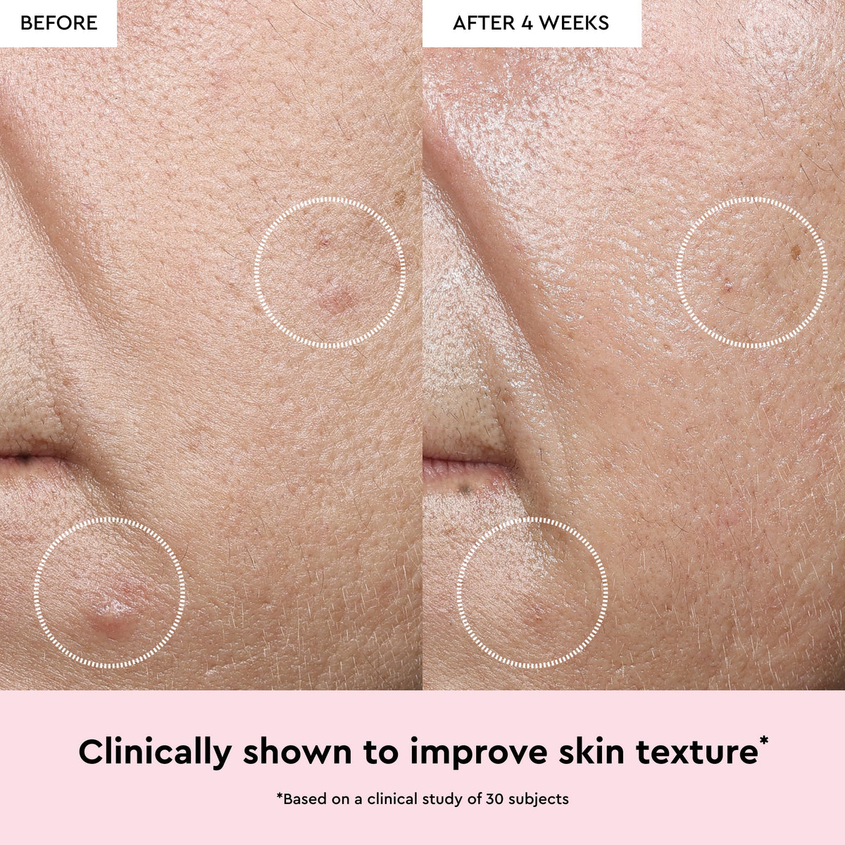 Glow Recipe Watermelon Glow Niacinamide Dew Drops