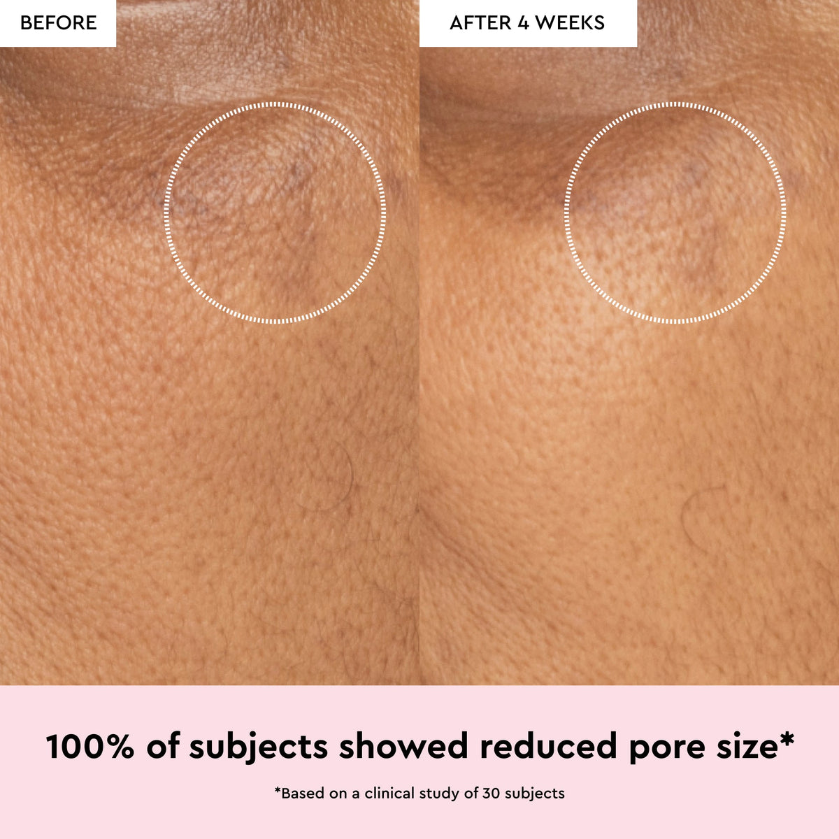 Glow Recipe Watermelon Glow Niacinamide Dew Drops