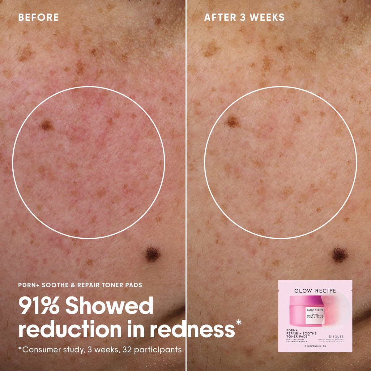 Glow Recipe Toner Pad Collection Kit
