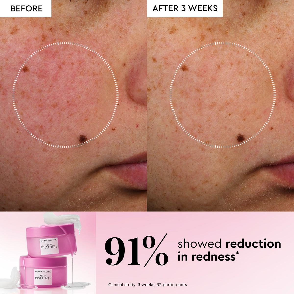 Glow Recipe Korean Toner Pad Trial & Travel Kit