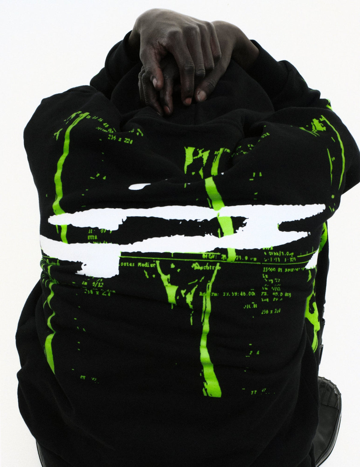 Sp5der X-RAY Hoodie