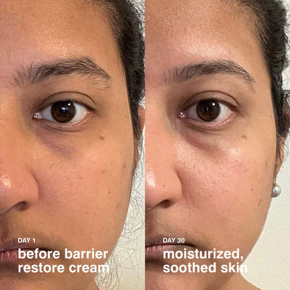 Mini Barrier Restore Cream Comforting Daily Moisturizer